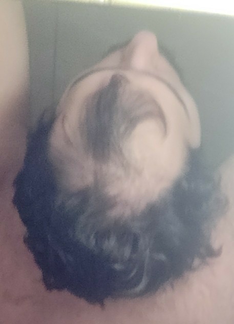 Should I wear hats or should I shave my head?