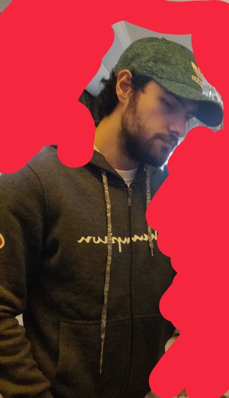 Should I wear hats or should I shave my head?