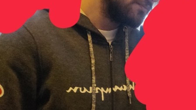 Should I wear hats or should I shave my head?