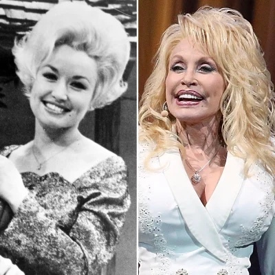 Do you find people that have had plastic surgery unattractive?