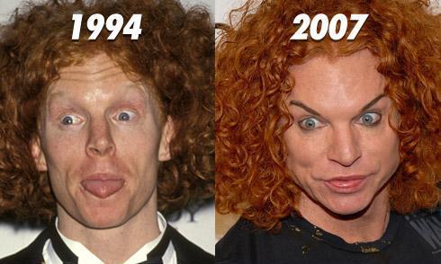 Do you find people that have had plastic surgery unattractive?