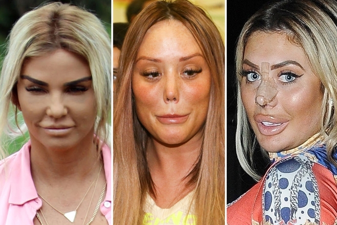 This is the cost of chasing "beauty" in Hollywood.