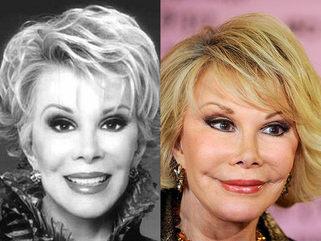 Do you find people that have had plastic surgery unattractive?
