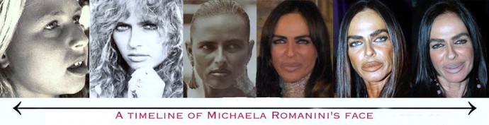 Do you find people that have had plastic surgery unattractive?