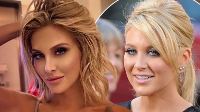 Do you find people that have had plastic surgery unattractive?
