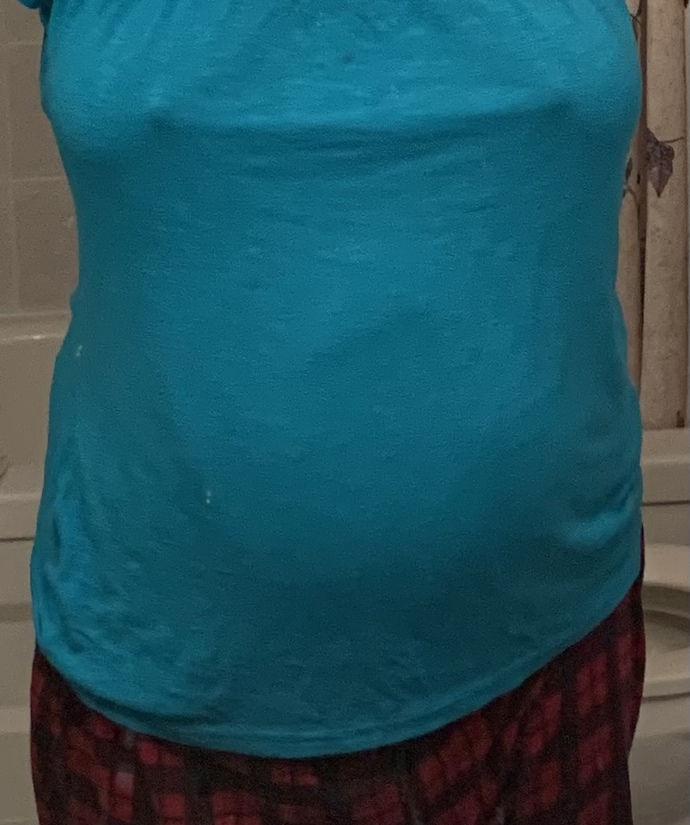 Guys, Is this body considered obese?