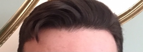 Does this hair have a healthy shine or greasy look?