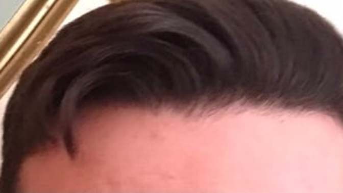 Does this hair have a healthy shine or greasy look?