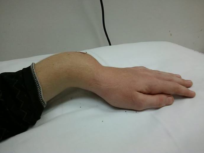 What ratings (out of 10) do you give yourself for dealing with these individually: physical pain, emotional hurt, and mental trauma?