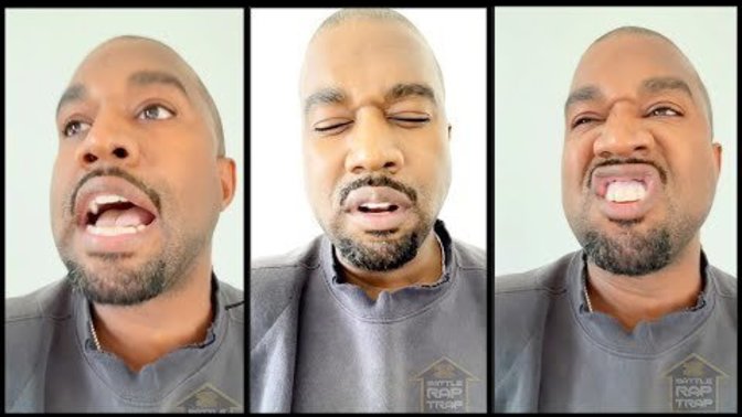 What do you think about Kanye's meltdown?