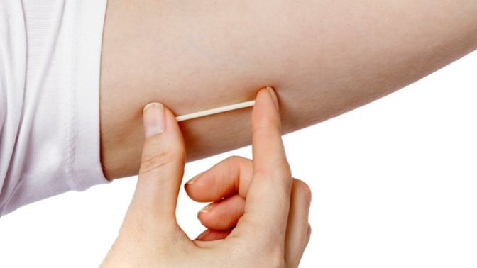 Girls, What is the arm implant birth control like?