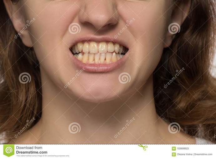 If a person looks attractive from head to toe, but their teeth, although straight, were a bit on the yellow side, Would that change your view?