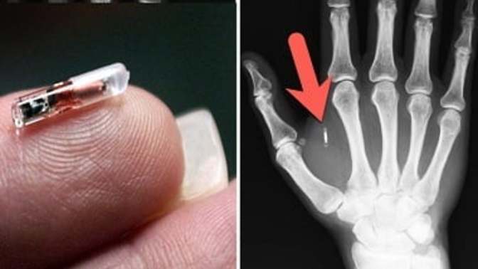 Would you get a microchip implanted given the advantages?