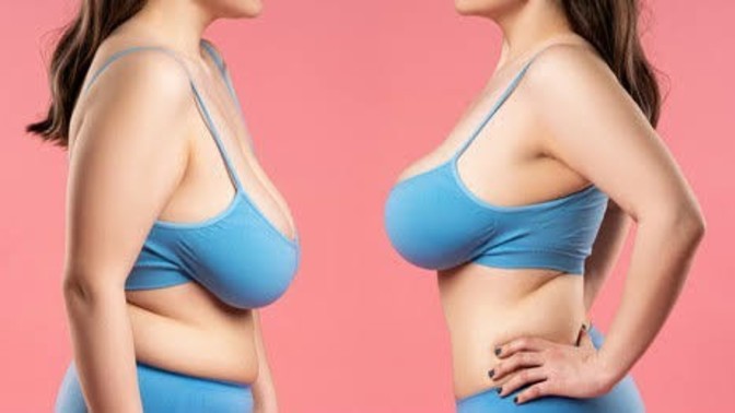 What can help lift/perk up my sagging breasts (besides surgery)?