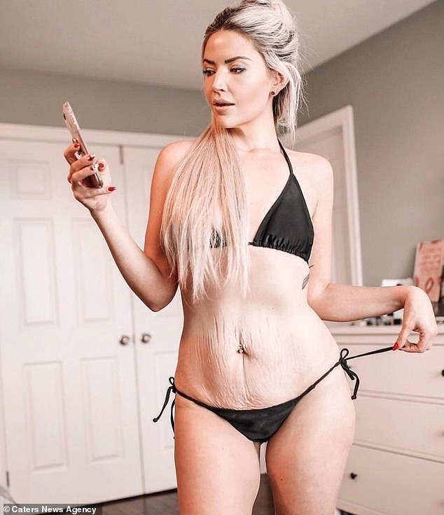 Would you date a woman with these imperfections: saggy skin and stretch marks?