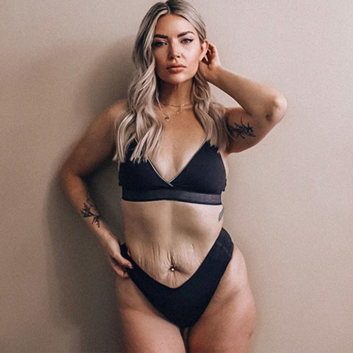 Would you date a woman with these imperfections: saggy skin and stretch marks?