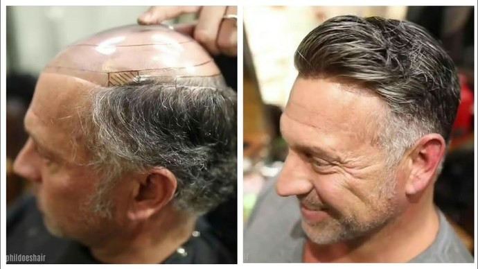 If your partner was balding, would you encourage them to cut it all off?