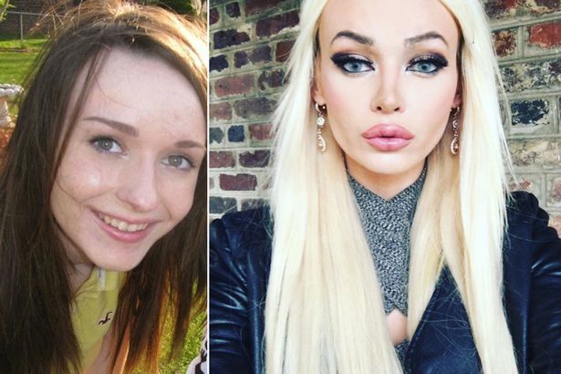 Is she prettier before or after plastic surgery?