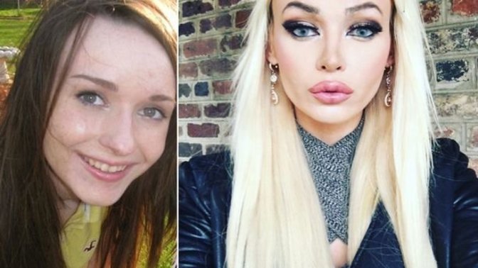 Is she prettier before or after plastic surgery?
