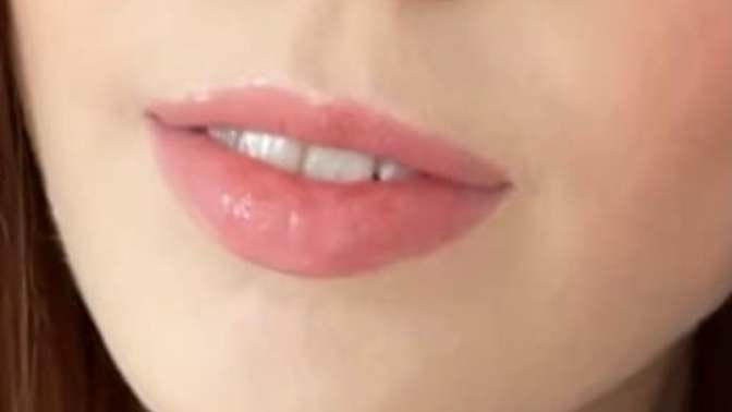 Should I consider lip injections?