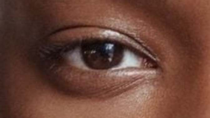 Why does my right eye keep twitching?