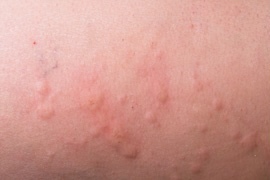 What is happening to my body?