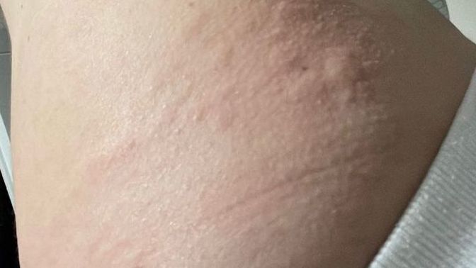 What is happening to my body?