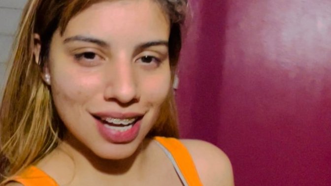 Get surgery on my nose or chin?