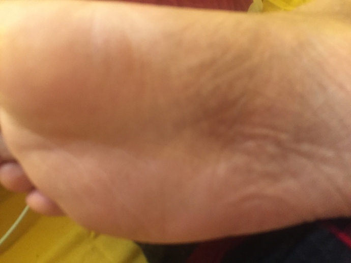 What to do if I step on glass? small glass and it seems it is in my feet now? is it ok to see a Doctor or hospital? does it seem I have a splinter?