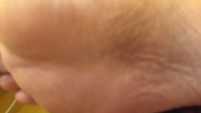 What to do if I step on glass? small glass and it seems it is in my feet now? is it ok to see a Doctor or hospital? does it seem I have a splinter?