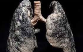 I smoked 2 packs of cigarettes in 14 hours. What would you say?