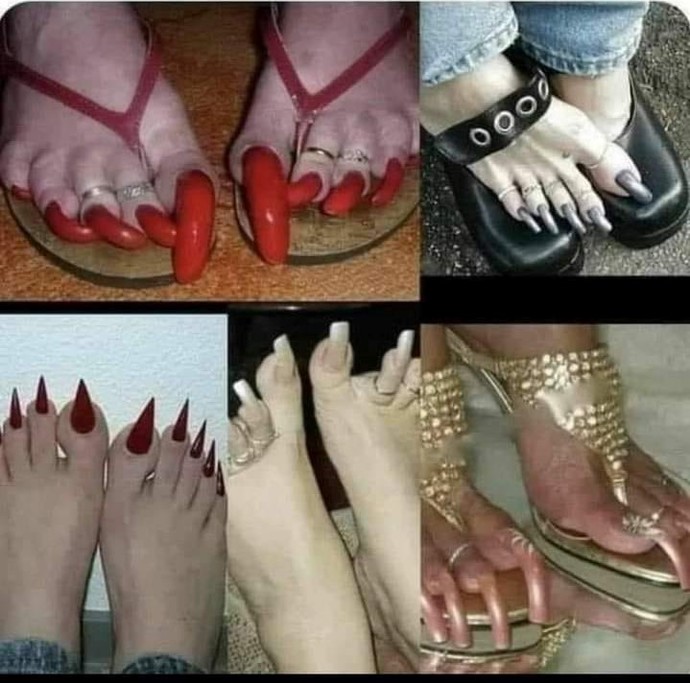 Are you looking forward to flip-flop season?