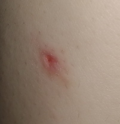 Would my skin be okay again after this cut?