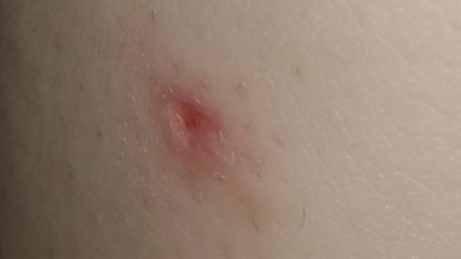 Would my skin be okay again after this cut?