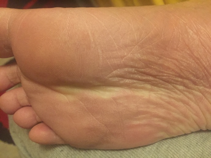 Should I GO hospital or something for my foot feet accident injury I had?