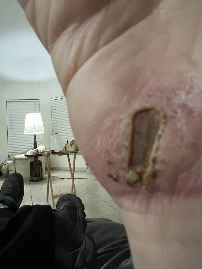Should I GO hospital or something for my foot feet accident injury I had?