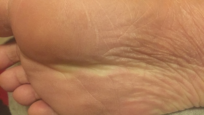 Should I GO hospital or something for my foot feet accident injury I had?
