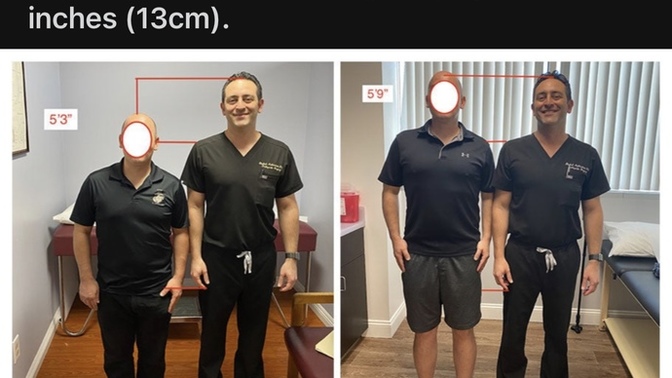 Would you get leg lengthening surgery if you had the chance?