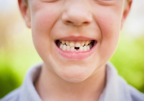 How old were you when you lost your first tooth?