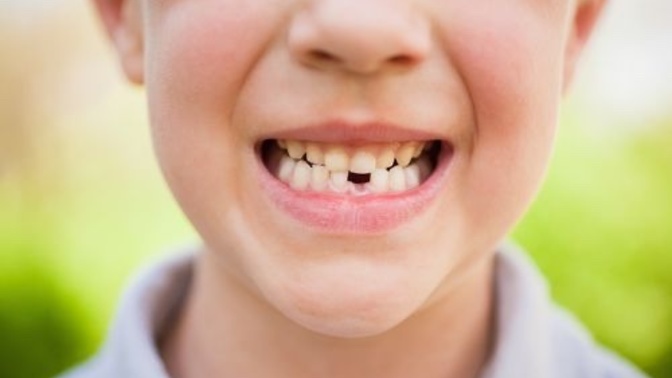 How old were you when you lost your first tooth?