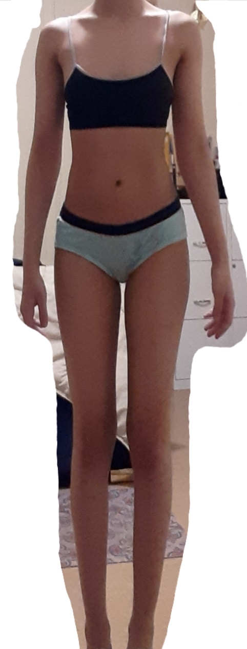 Is anything that I can improve, should I gain weight?