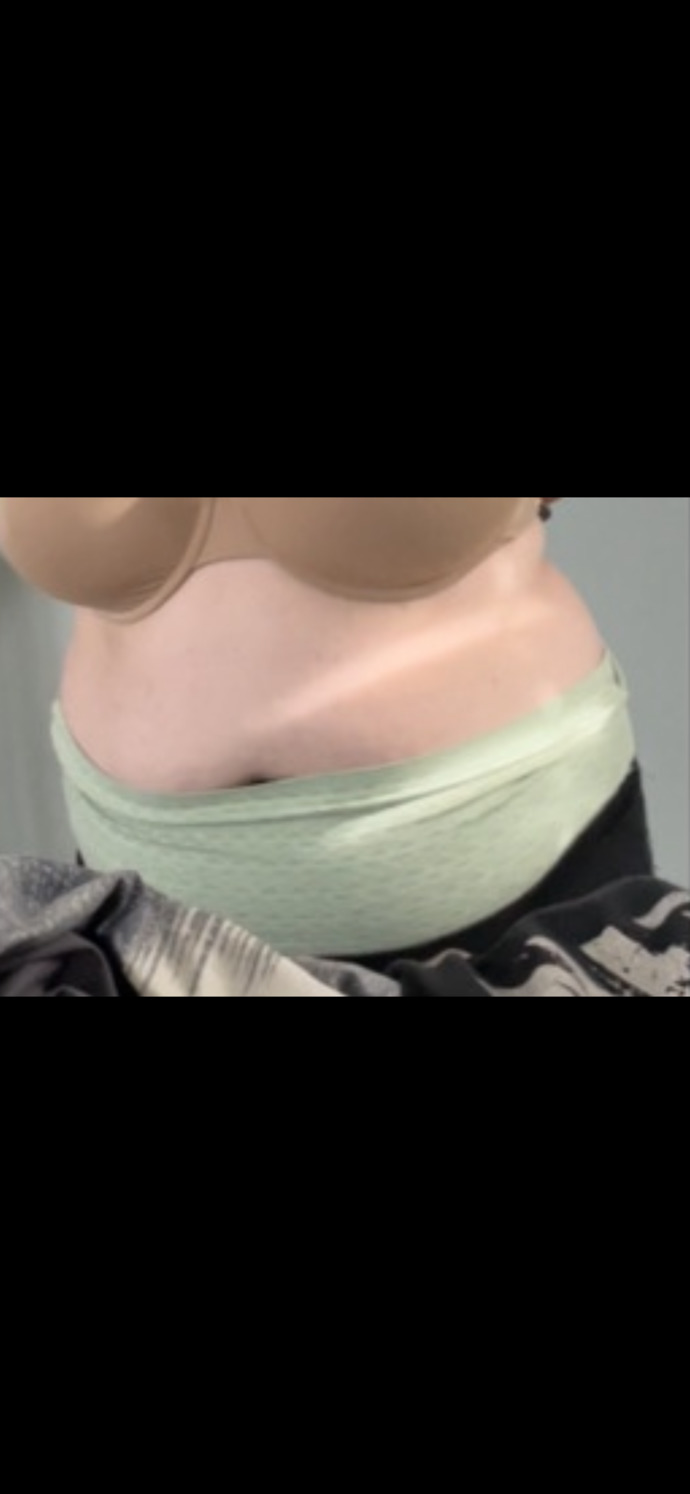 Why do some girls grow such a big belly?