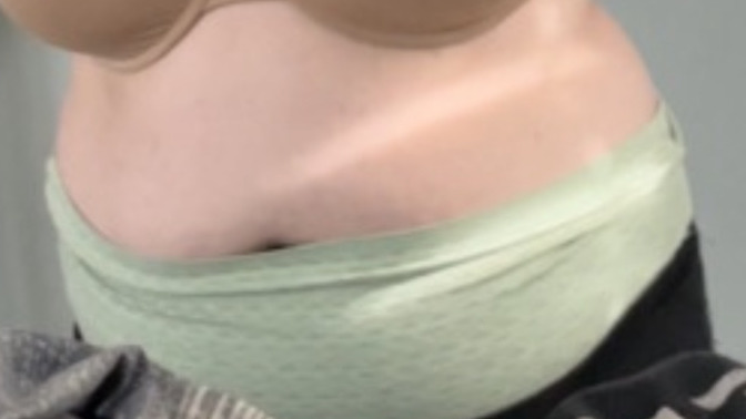 Why do some girls grow such a big belly?