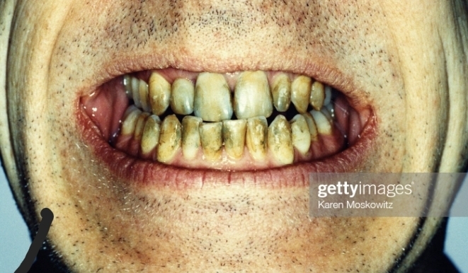 Are you happy with your teeth?