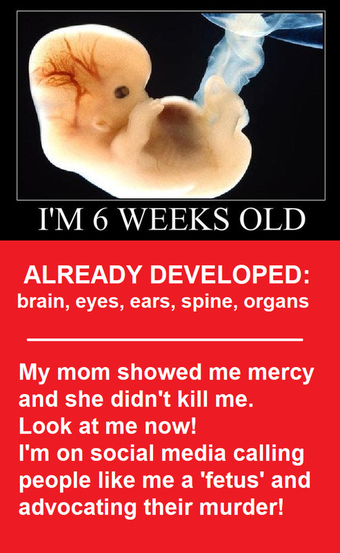 Is a fetus a human being? I think it is. What about you?