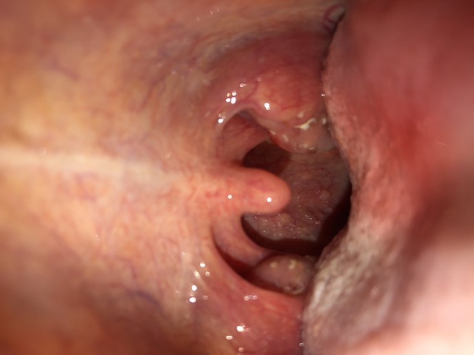 Do you know what wrong with my throat?