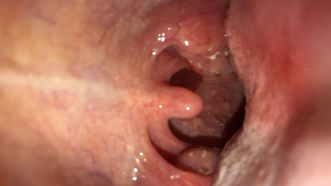 Do you know what wrong with my throat?