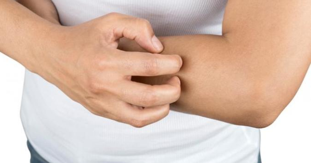 Why does scratching an itch feel so good? GirlsAskGuys