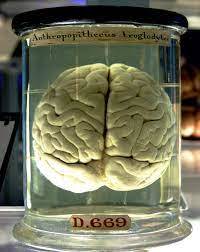 Would you want a brain in a jar?