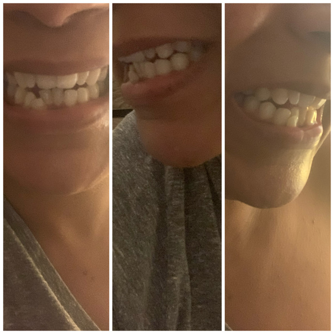Guys, Would you date a woman with teeth like this?